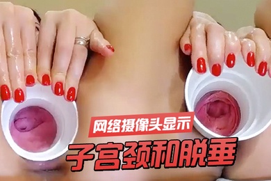 子宫颈和脱垂网络摄像头显示